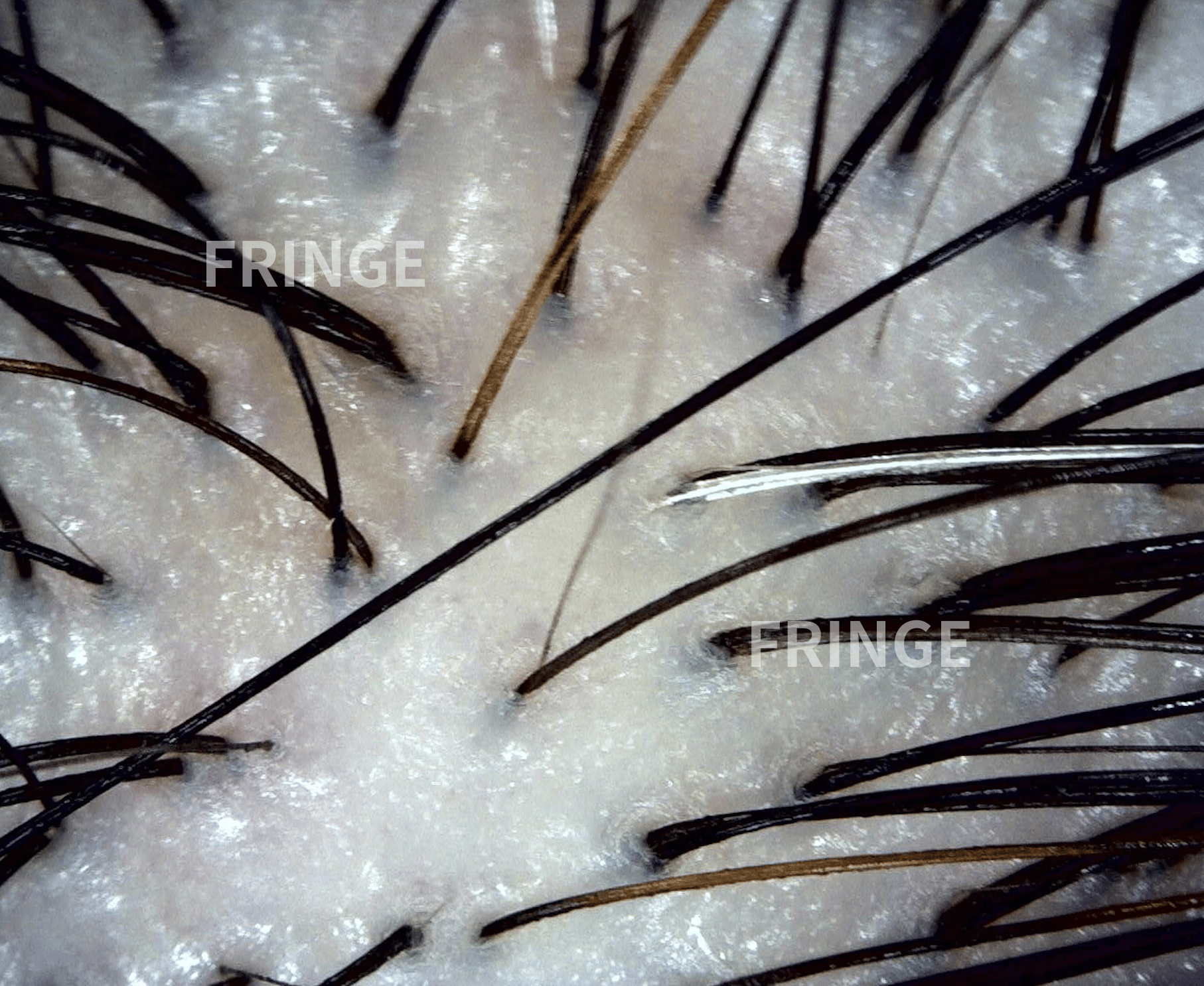 FRINGEの文字が入った頭皮と毛髪の拡大写真
